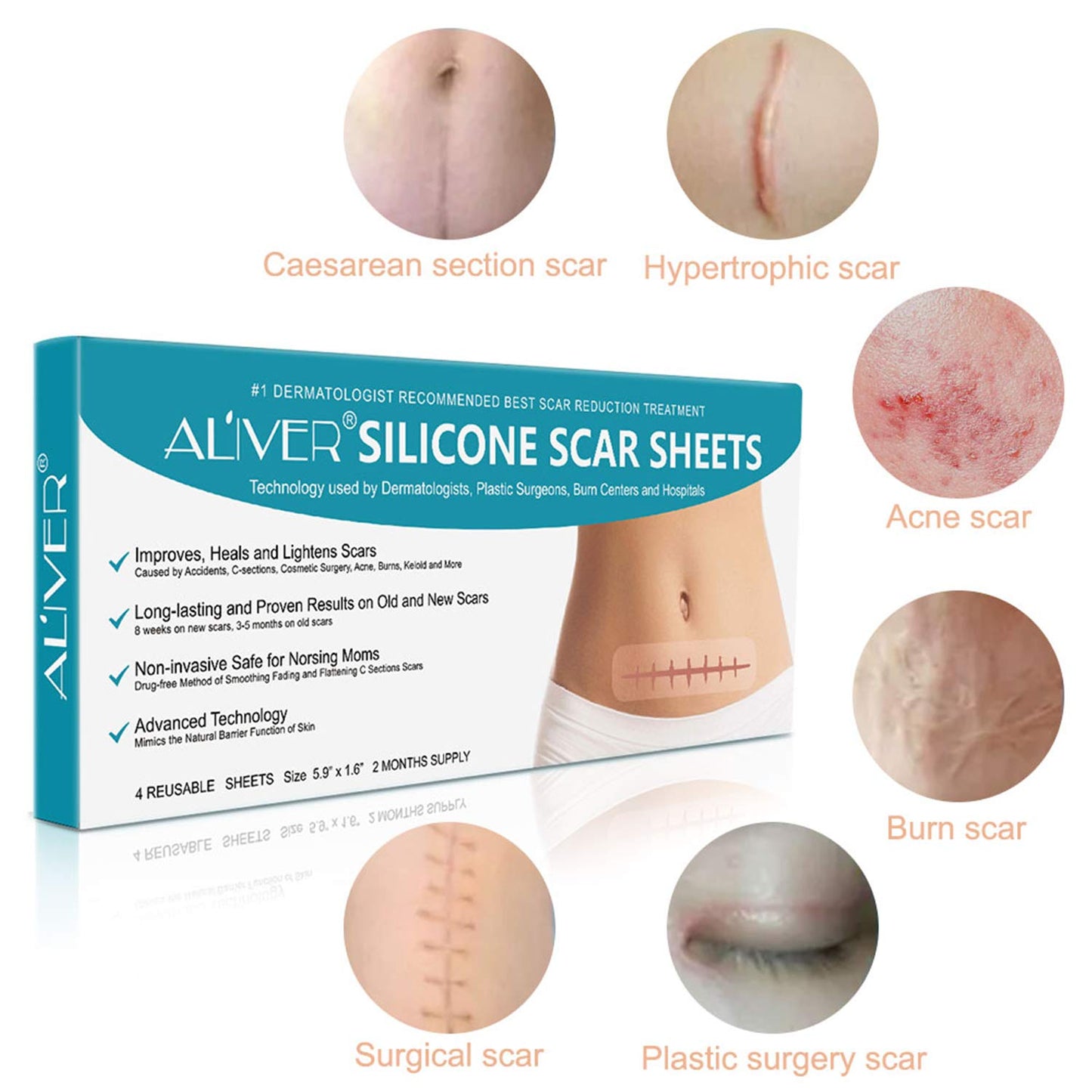 Aliver Hojas de Silicona Impermeables para Cicatrices 4 Uds